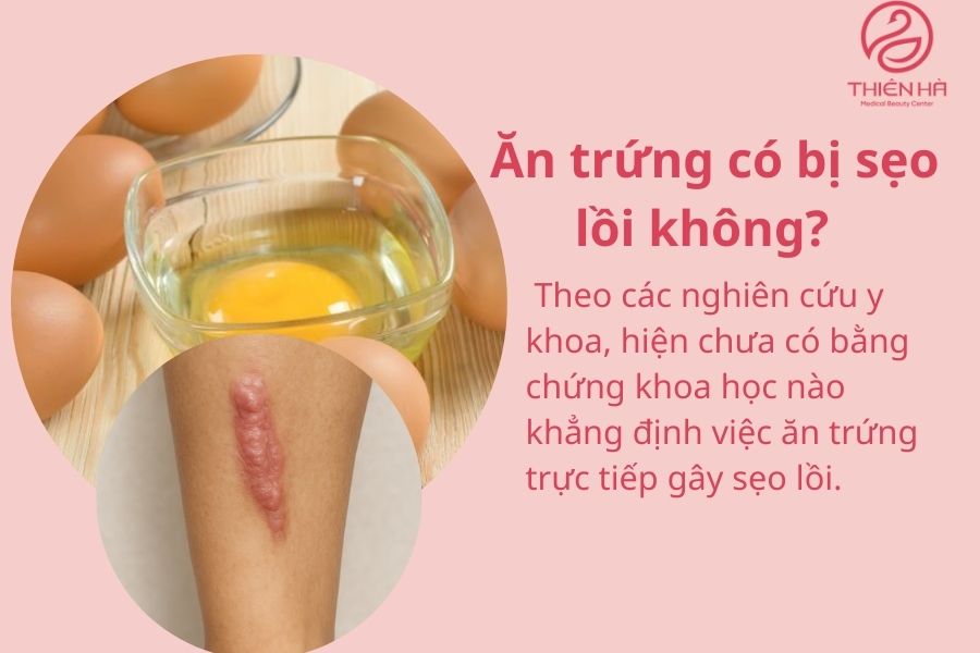 Ăn trứng có bị sẹo lồi không? Sự thật khoa học & lời khuyên từ bác sĩ 2 Ăn trứng có bị sẹo lồi không?