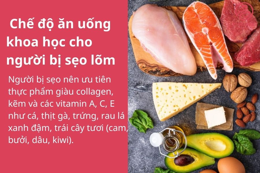 Bị sẹo lõm có nên ăn rau muống không ? Lời khuyên cho người bị sẹo lõm 4 Chế độ ăn uống khoa học cho người bị sẹo lõm