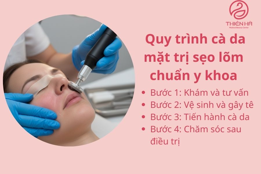 Cà da mặt trị sẹo lõm có hiệu quả không? Giải đáp từ chuyên gia 3 Quy trình cà da mặt trị sẹo lõm chuẩn y khoa