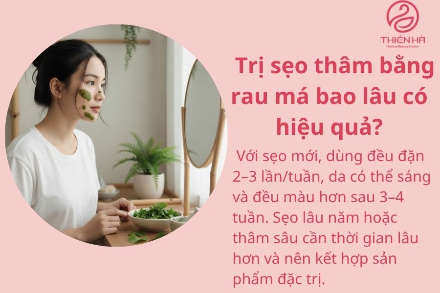 Một số câu hỏi thường gặp 