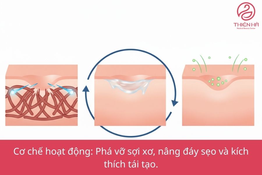 Cơ chế hoạt động