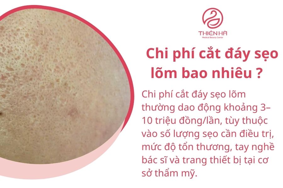 Chi phí cắt đáy sẹo lõm là bao nhiêu ?