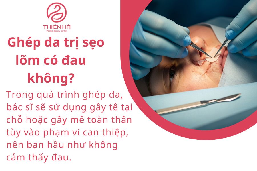 Ghép da trị sẹo lõm - Giải pháp tái tạo da chuyên sâu từ A - Z 6 Một số câu hỏi thường gặp