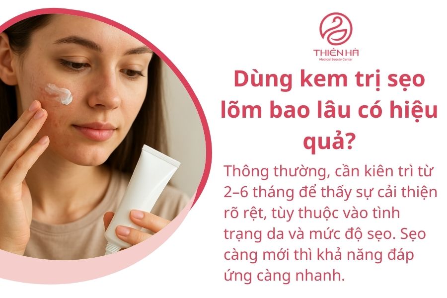 Một số câu hỏi thường gặp 