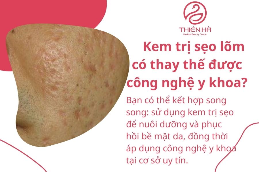 Kem trị sẹo lõm có thực sự thay thế được công nghệ y khoa