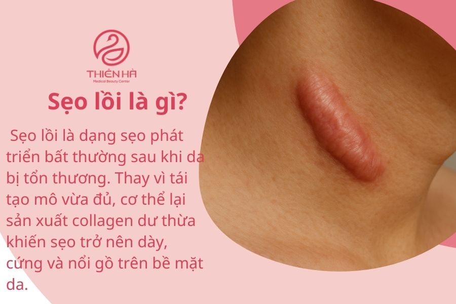 Kiêng Ăn Gì Để Không Bị Sẹo Lồi? 10 Thực Phẩm Cần Tránh 1 Sẹo lồi là gì?