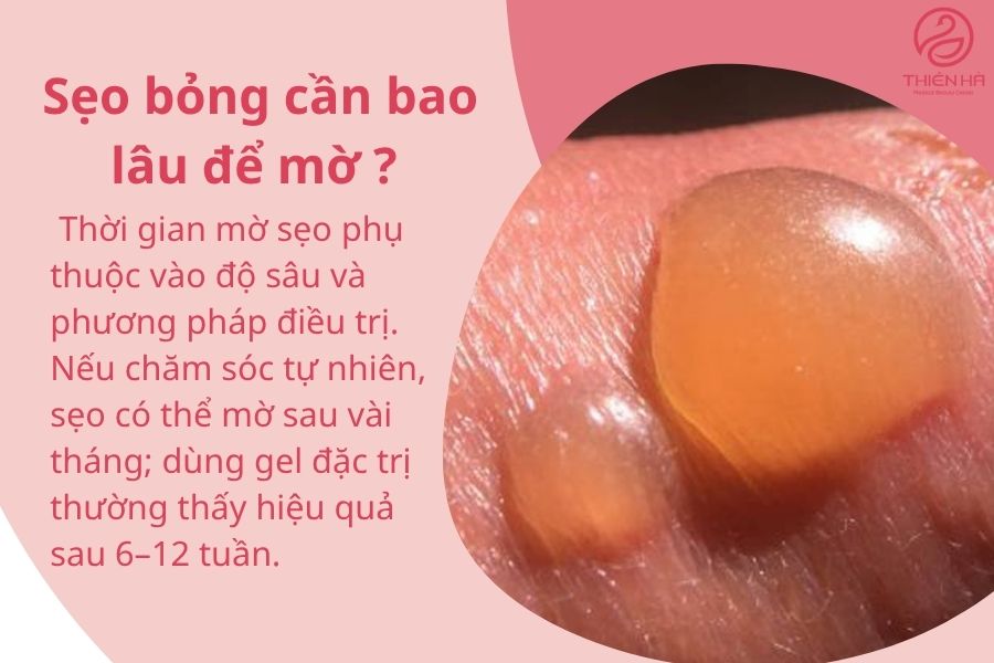 Điều trị sẹo bỏng hiệu quả: từ sơ cứu ban đầu đến công nghệ y khoa 8 Câu hỏi thường gặp về sẹo bỏng