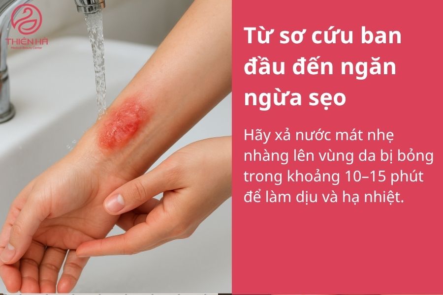 Điều trị sẹo bỏng hiệu quả: từ sơ cứu ban đầu đến công nghệ y khoa 3 Sơ cứu sẹo bỏng ban đầu