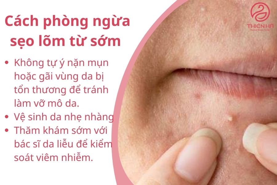 Sẹo lõm: Nguyên nhân, cách điều trị hiệu quả và chi phí cụ thể 6 Cách phòng ngừa sẹo lõm từ sớm