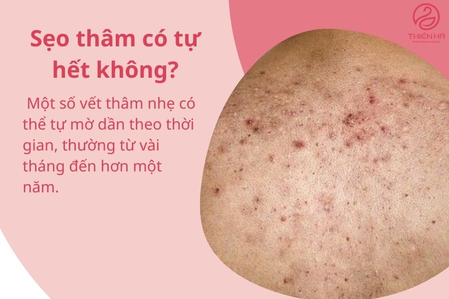 Một số câu hỏi thường gặp 