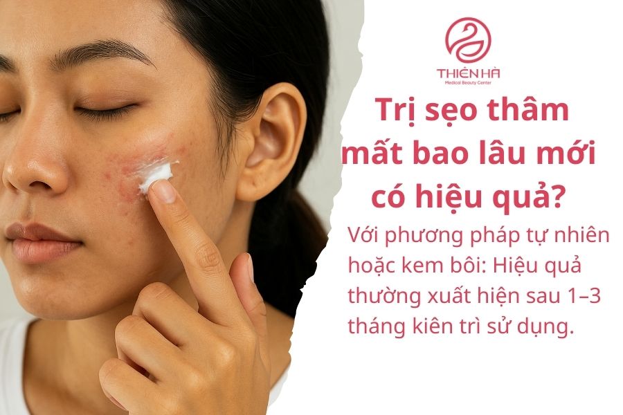 Trị sẹo thâm mất bao lâu mới có hiệu quả?