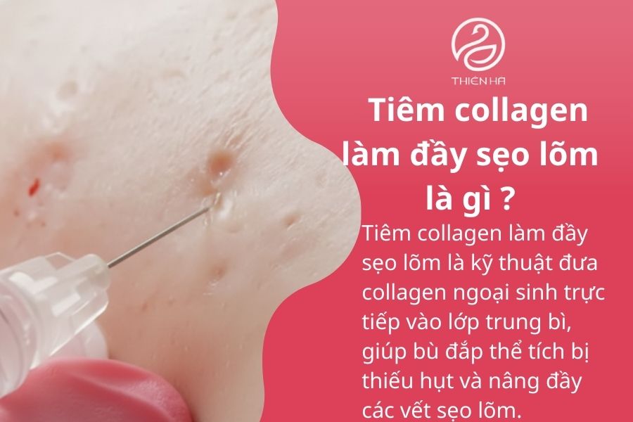 Tiêm collagen làm đầy sẹo lõm: hiệu quả nhanh, an toàn, kéo dài 1 Tiêm collagen làm đầy sẹo lõm là gì ?
