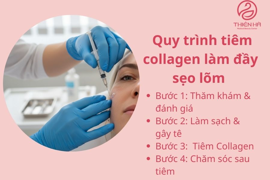 Tiêm collagen làm đầy sẹo lõm: hiệu quả nhanh, an toàn, kéo dài 3 Quy trình tiêm collagen làm đầy sẹo chuẩn y khoa
