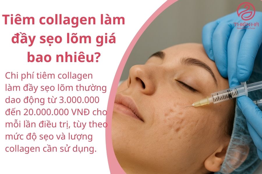 Tiêm collagen làm đầy sẹo lõm: hiệu quả nhanh, an toàn, kéo dài 4 Tiêm collagen làm đầy sẹo lõm giá bao nhiêu?