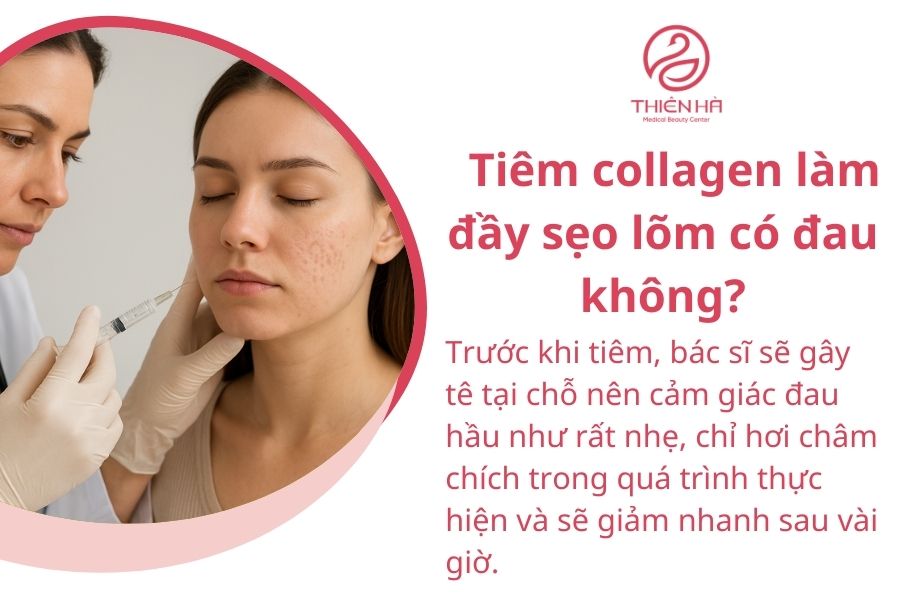Tiêm collagen làm đầy sẹo lõm: hiệu quả nhanh, an toàn, kéo dài 6 Tiêm collagen có đau không?