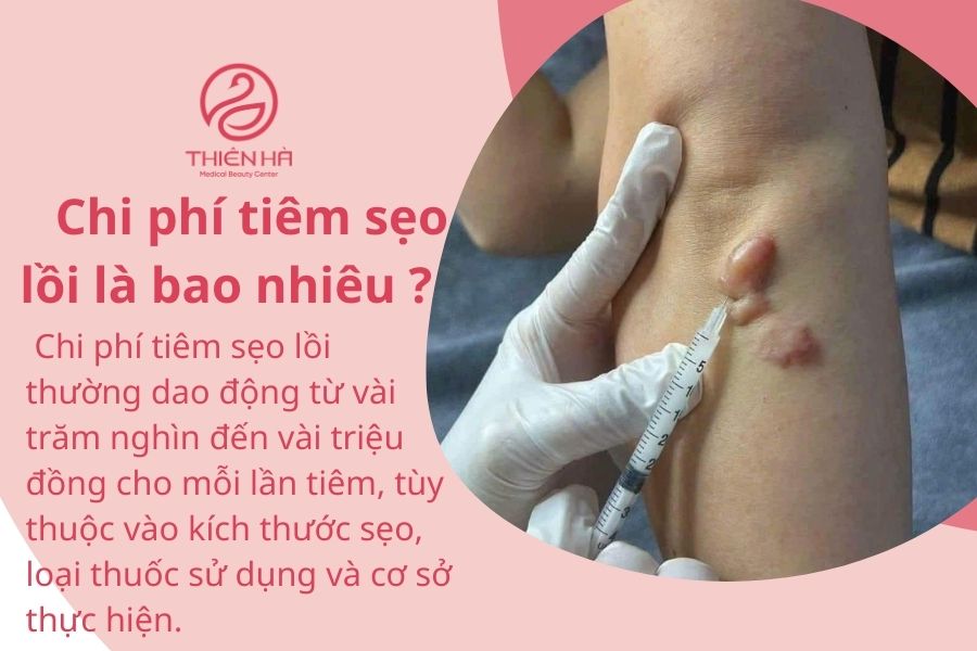 Chi phí tiêm sẹo lồi là bao nhiêu ? 