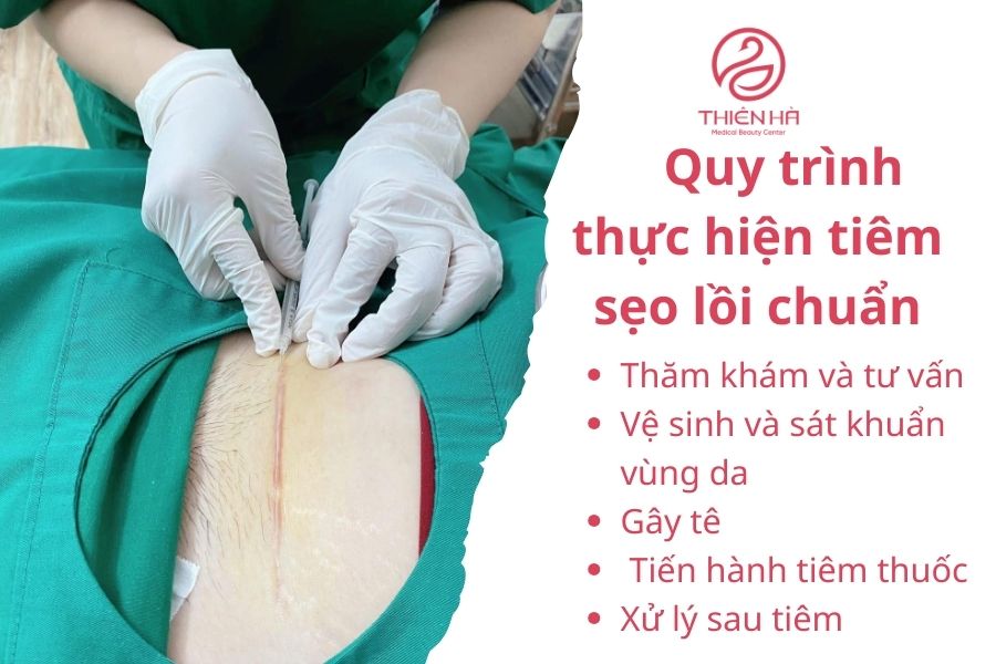 Quy trình thực hiện tiêm sẹo lồi 