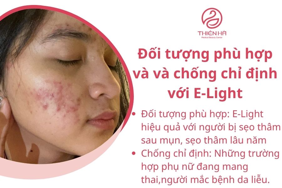 Đối tượng phù hợp và và chống chỉ định với E-Light