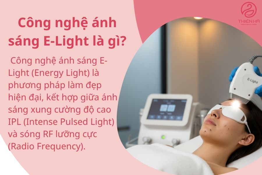 Công nghệ ánh sáng E-Light là gì?