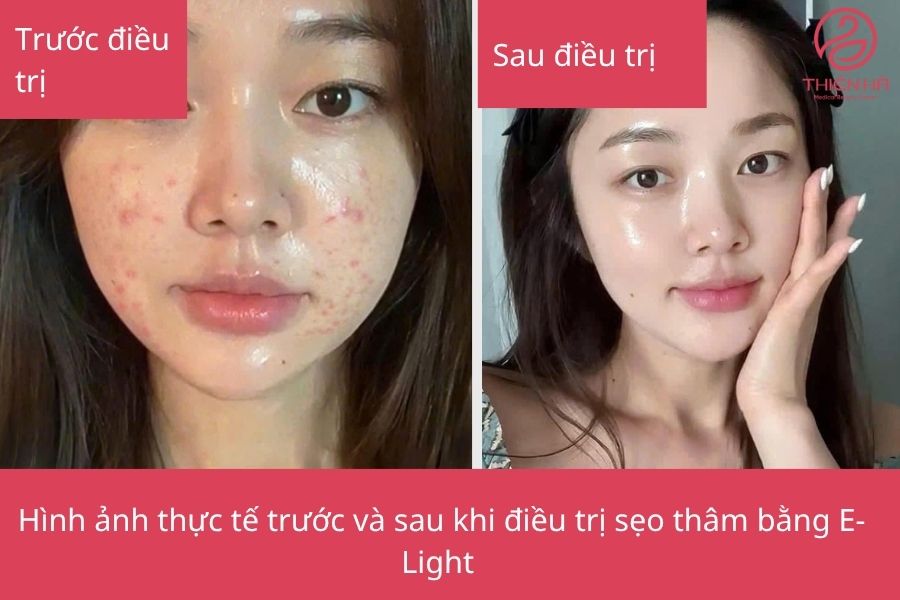 Kết quả sau điều trị 