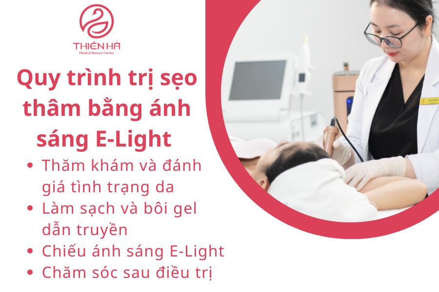 Quy trình trị sẹo thâm bằng ánh sáng E-Light chuẩn y khoa tại Viện thẩm mỹ Thiên Hà 