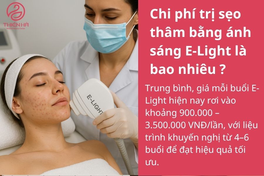 Chi phí trị sẹo thâm bằng ánh sáng E-Light là bao nhiêu ? 