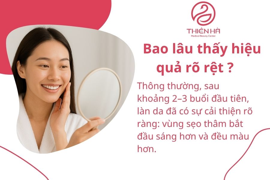 Một số câu hỏi thường gặp