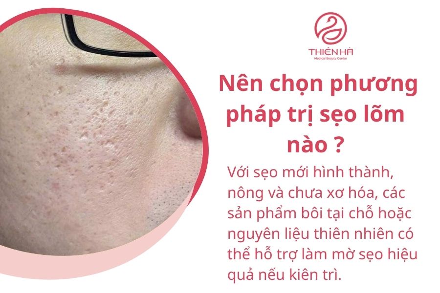 Tất tần tật cách trị sẹo lõm từ A-Z an toàn, chuyên gia khuyên dùng 4 Nên chọn phương pháp trị sẹo lõm nào?