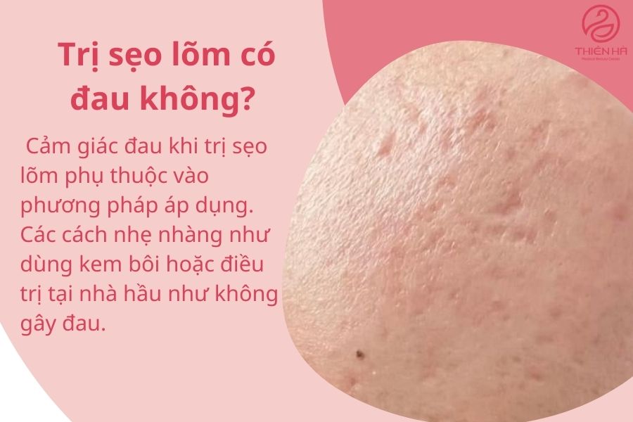 Tất tần tật cách trị sẹo lõm từ A-Z an toàn, chuyên gia khuyên dùng 7 Một số câu hỏi thường gặp