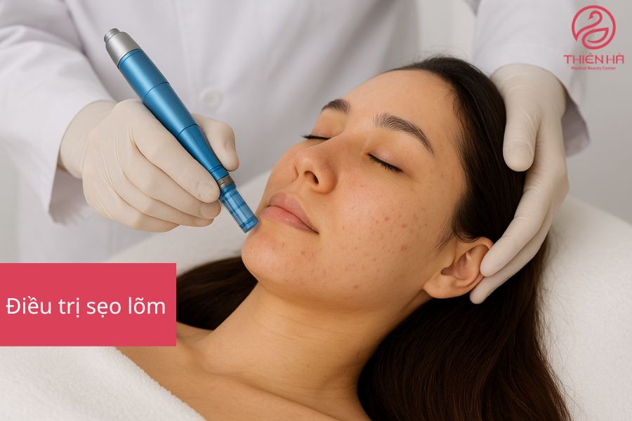 Trị sẹo lõm bao nhiêu tiền? Xem ngay bảng giá chi tiết mới nhất 2 Điều trị sẹo lõm