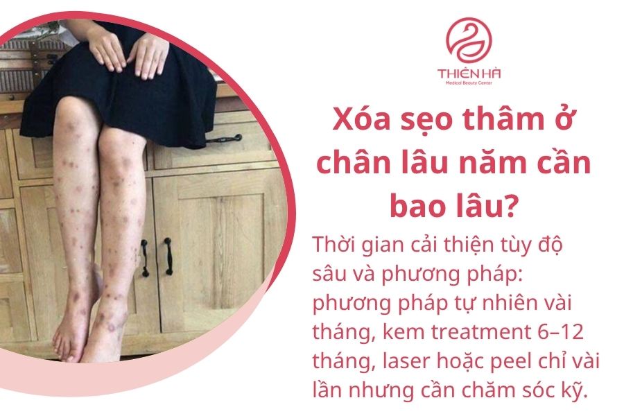 Một số câu hỏi thường gặp 