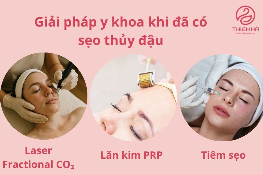 Giải pháp y khoa khi đã có sẹo thủy đậu