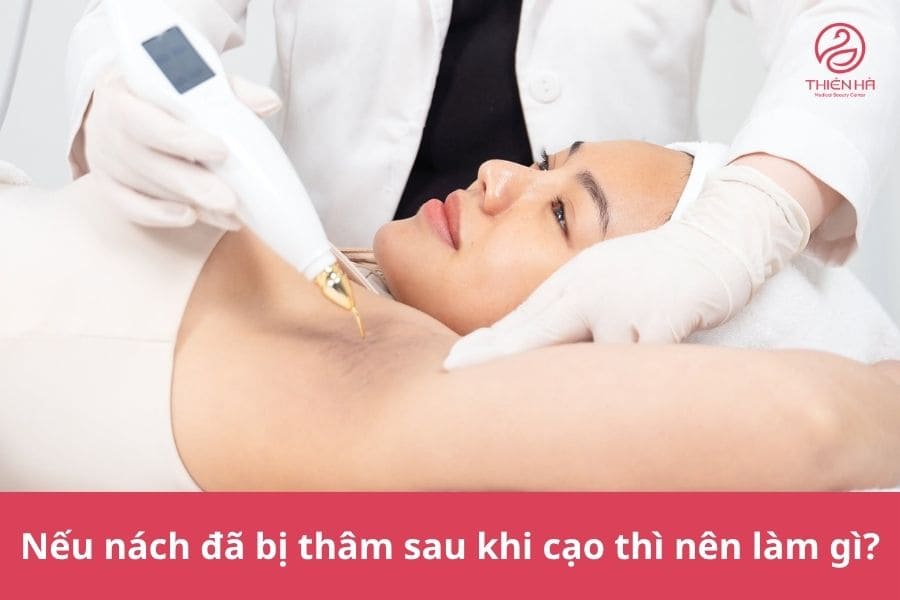 Cách cạo lông nách không bị thâm sạm, da vẫn mịn sáng tự nhiên 6 Thăm khám tại các cơ sở thẩm mỹ hoặc y tế để được điều trị bằng phương pháp công nghệ cao khi nách bị thâm lâu năm, sẫm màu