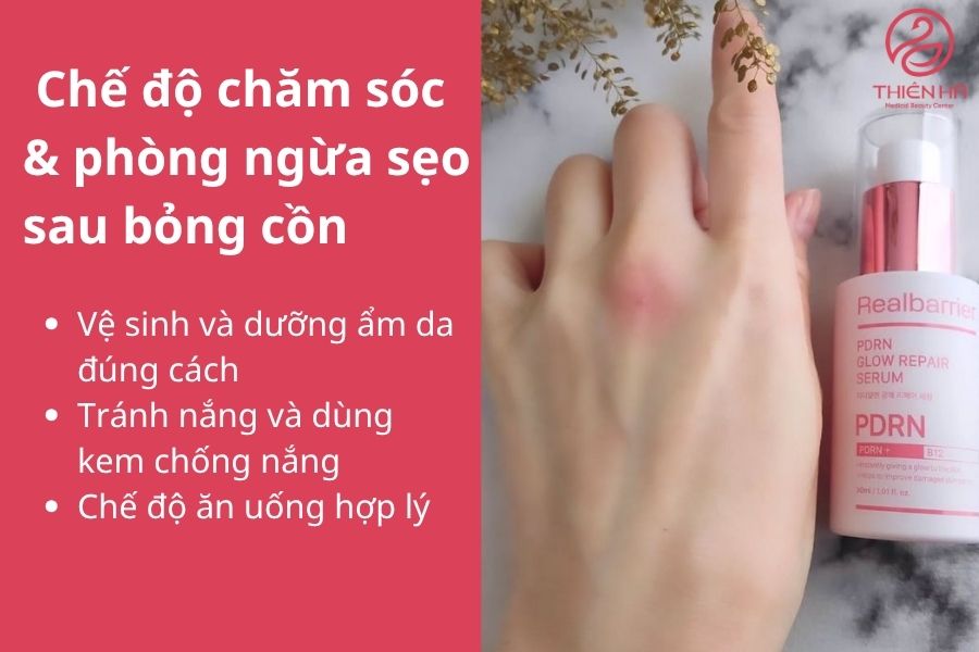 Top 10+ cách trị sẹo bỏng cồn nhanh chóng, an toàn tại nhà & spa 6 Chế độ chăm sóc & phòng ngừa sẹo sau bỏng cồn