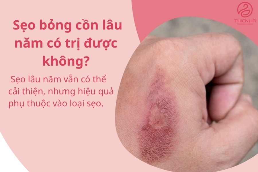 Top 10+ cách trị sẹo bỏng cồn nhanh chóng, an toàn tại nhà & spa 7 Một số câu hỏi thường gặp
