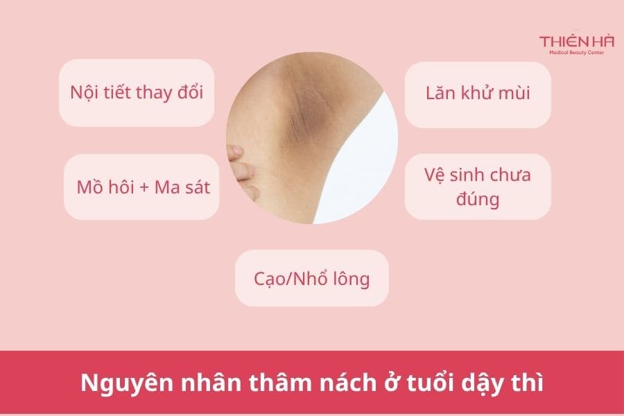 Nguyên nhân thâm nách ở tuổi dậy thì