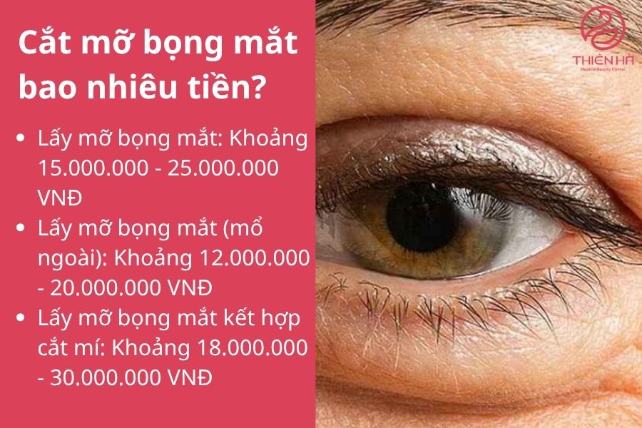 Cắt mỡ bọng mắt bao nhiêu tiền? 