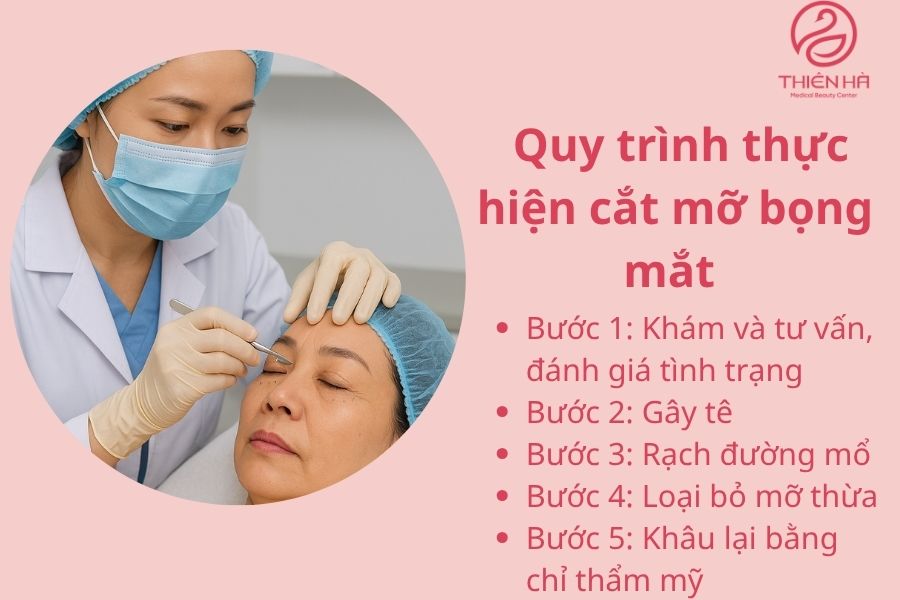 Quy trình thực hiện cắt mỡ bọng mắt – bước từng bước