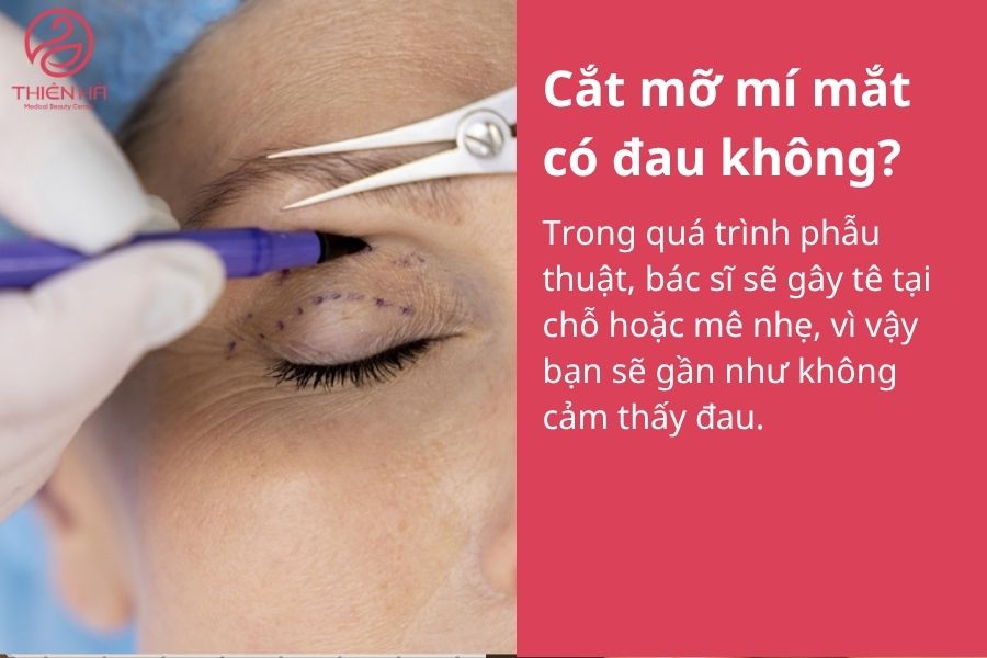 Tìm hiểu cắt mỡ mí mắt: phương pháp, chi phí và rủi ro cần tránh 7 Một số câu hỏi thường gặp : Cắt mỡ mí mắt có đau không