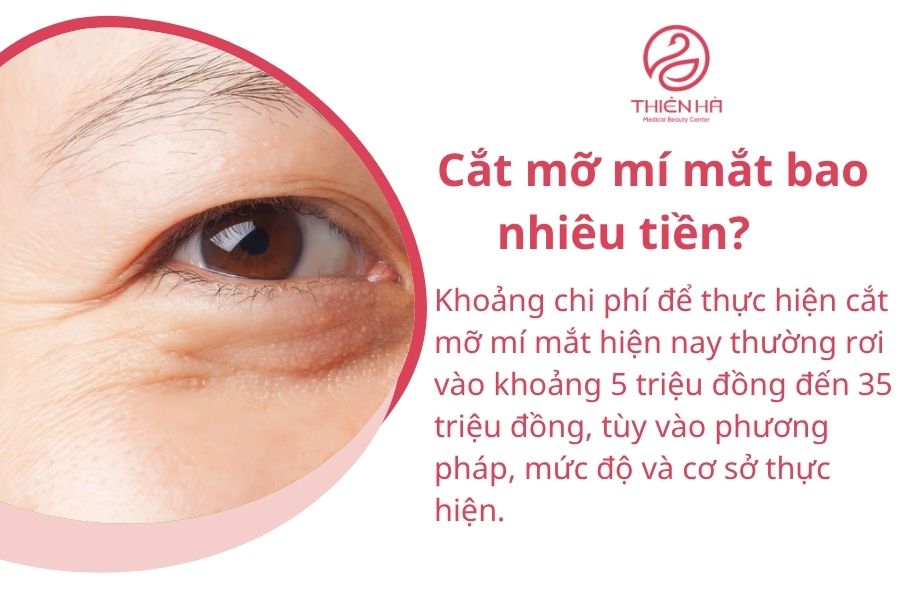 Tìm hiểu cắt mỡ mí mắt: phương pháp, chi phí và rủi ro cần tránh 3 Cắt mỡ mí mắt bao nhiêu tiền?