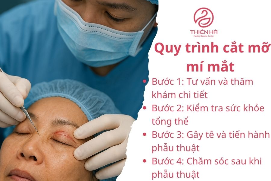 Tìm hiểu cắt mỡ mí mắt: phương pháp, chi phí và rủi ro cần tránh 4 Quy trình cắt mỡ mí mắt