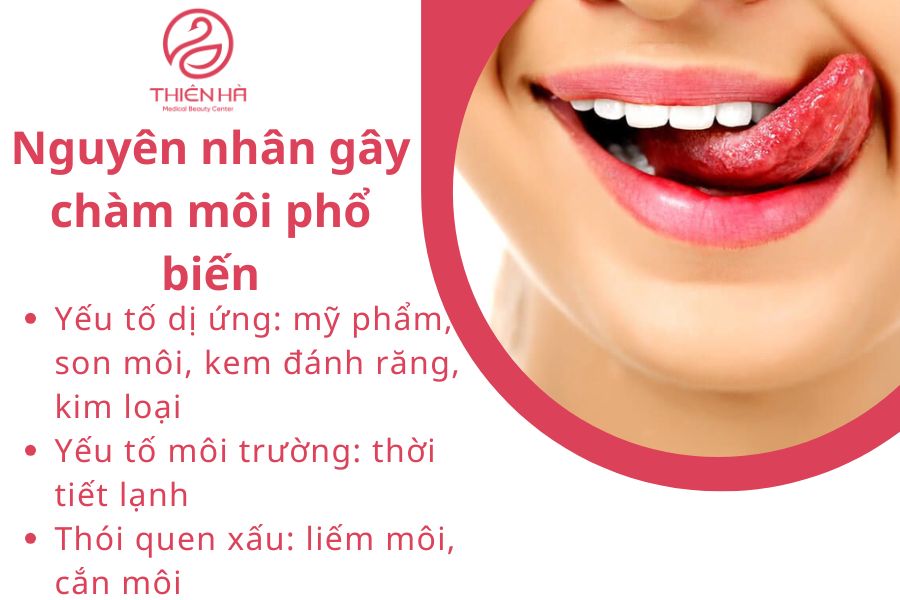 Chàm môi là gì? Nguyên nhân, dấu hiệu và cách điều trị hiệu quả 2 Thói quen xấu: liếm môi