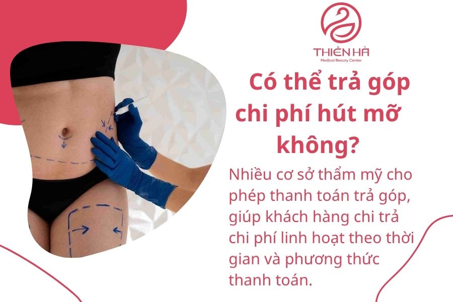 Hút mỡ bao nhiêu tiền? Bảng giá mới nhất và chi phí từng vùng 8 Có thể trả góp chi phí hút mỡ không?