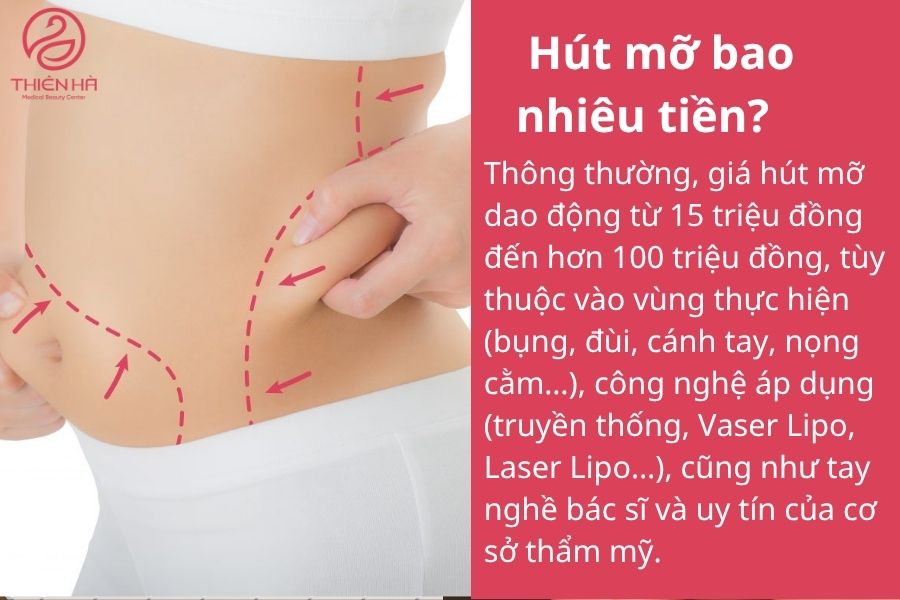 Hút mỡ bao nhiêu tiền? Bảng giá mới nhất và chi phí từng vùng 2 Hút mỡ bao nhiêu tiền?