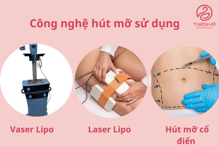 Hút mỡ bao nhiêu tiền? Bảng giá mới nhất và chi phí từng vùng 3 Công nghệ hút mỡ sử dụng