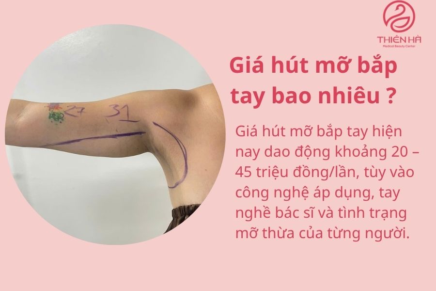 Hút mỡ bắp tay là gì? Quy trình, chi phí và lưu ý an toàn cần biết 5 Giá hút mỡ bắp tay bao nhiêu