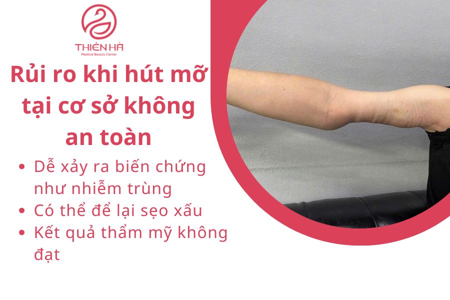 Hút mỡ bắp tay giá bao nhiêu? Bảng giá chi tiết và lưu ý an toàn 4 Rủi ro khi hút mỡ tại cơ sở không an toàn