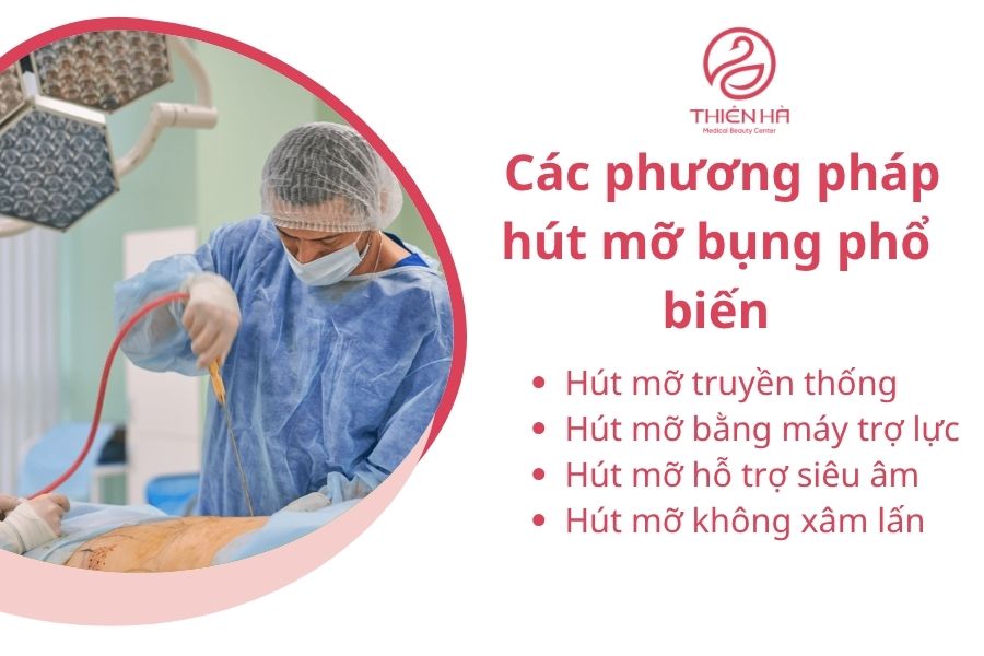 Hút mỡ bụng: Ưu điểm, rủi ro tiềm ẩn và tiêu chí chọn nơi uy tín 3 Các phương pháp hút mỡ bụng phổ biến