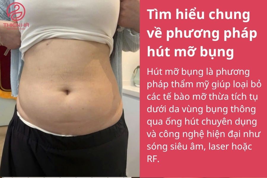 Hút mỡ bụng bao nhiêu tiền? Bảng giá chi tiết mới nhất hiện nay 1 Tìm hiểu chung về phương pháp hút mỡ bụng