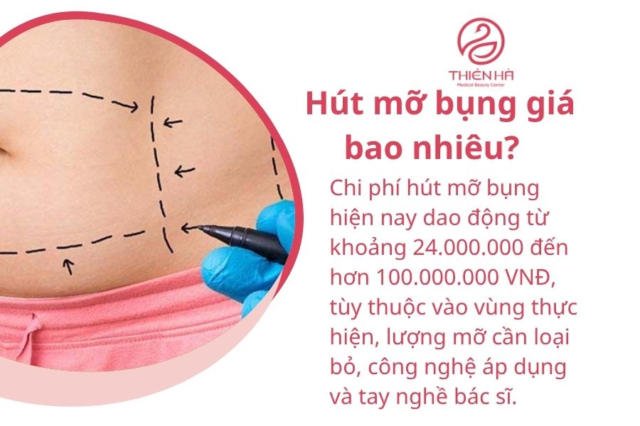 Hút mỡ bụng bao nhiêu tiền? Bảng giá chi tiết mới nhất hiện nay 2 Hút mỡ bụng giá bao nhiêu?